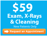 Santa Maria Dental coupon Exam and X-Rays